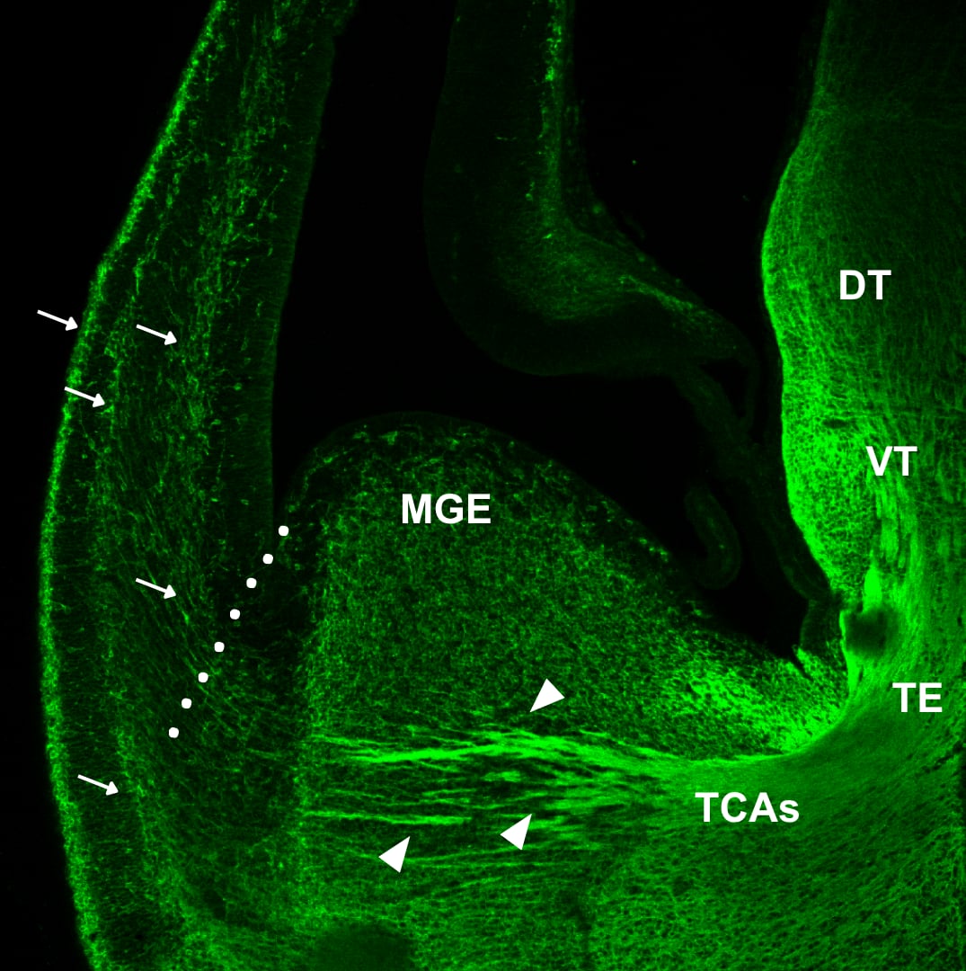 Micrografía verde con un haz de axones talamocorticales, rótulos anatómicos, flechas y una línea de puntos en la frontera cortical.